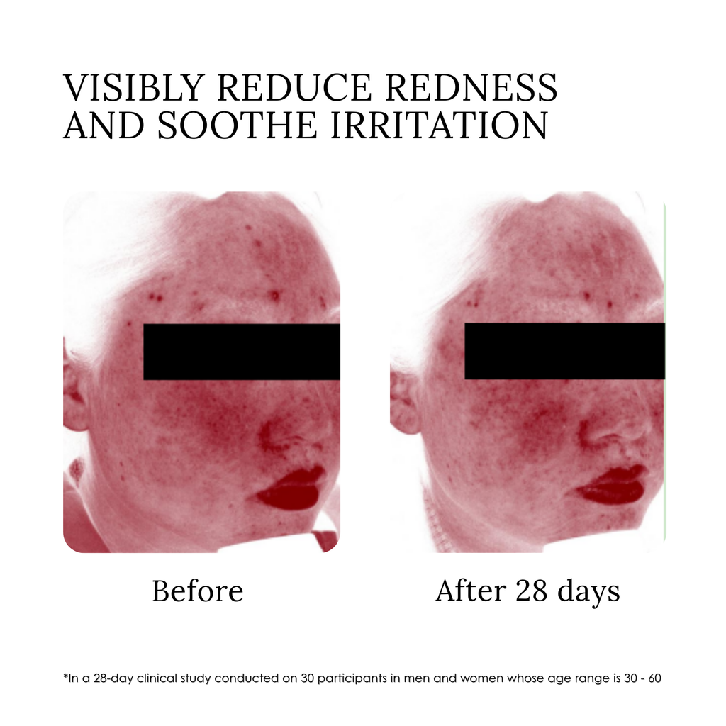 elvis+elvin Rose Revitalizing Treatment Mask 3.0