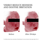 elvis+elvin Rose Revitalizing Treatment Mask 3.0
