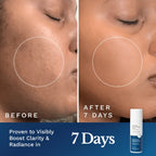 Clear Out Skin Clarifying Cream