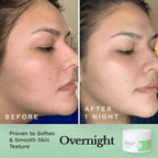 Glycolic Resurfacing Peel Pads