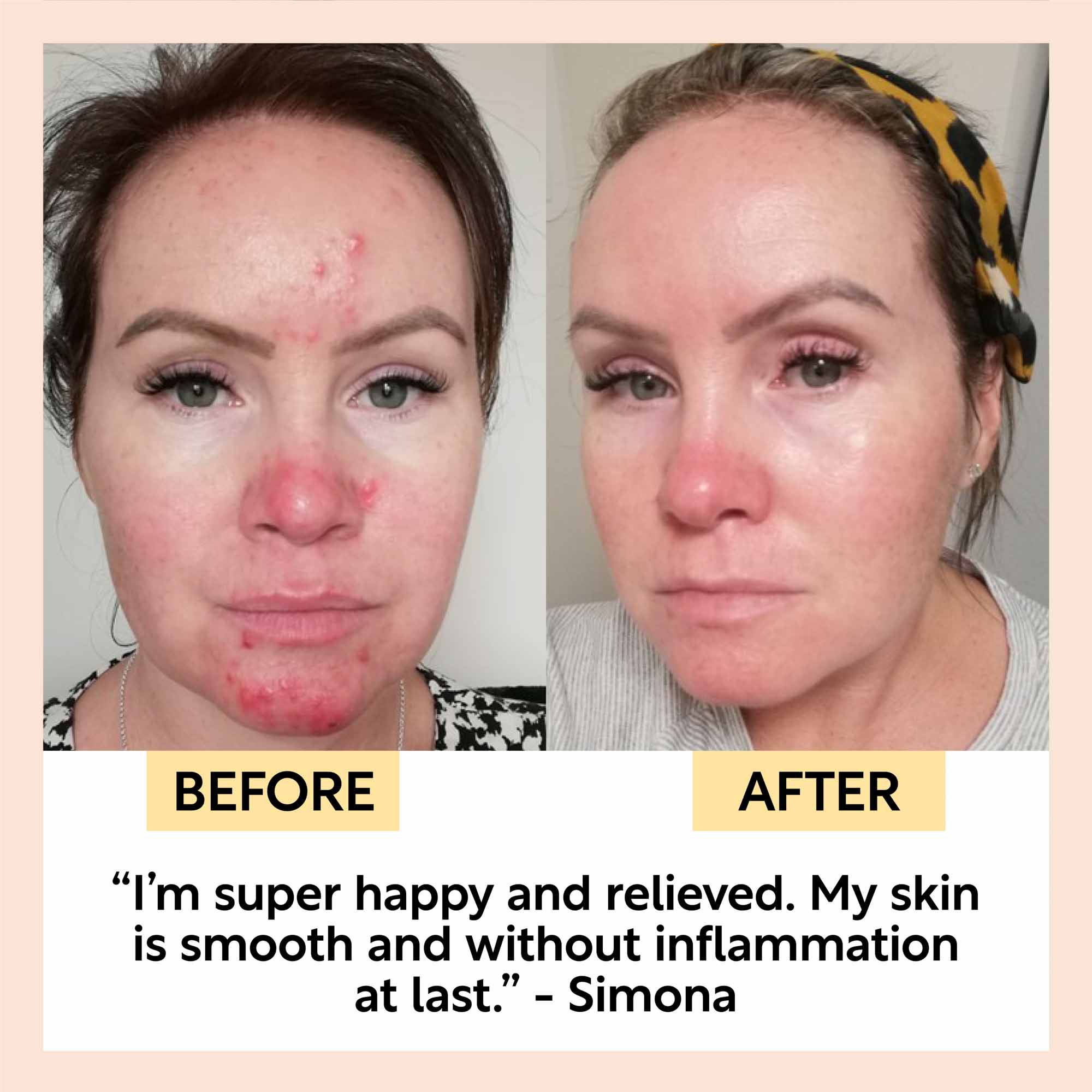 Night Cream with Hyaluronic Acid + Niacinamide