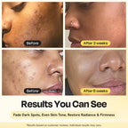 Superactive Serum