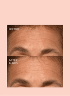Triple Lift Molecule Mask